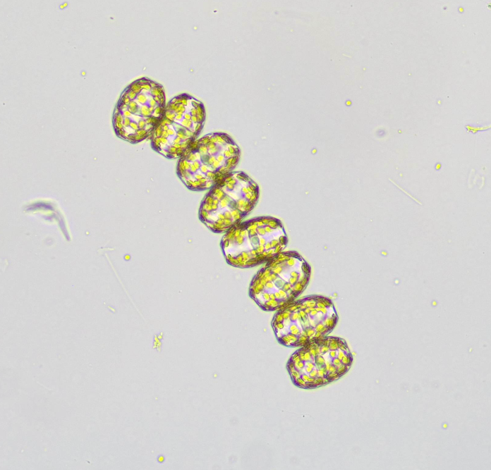 Microscopic plankton chains