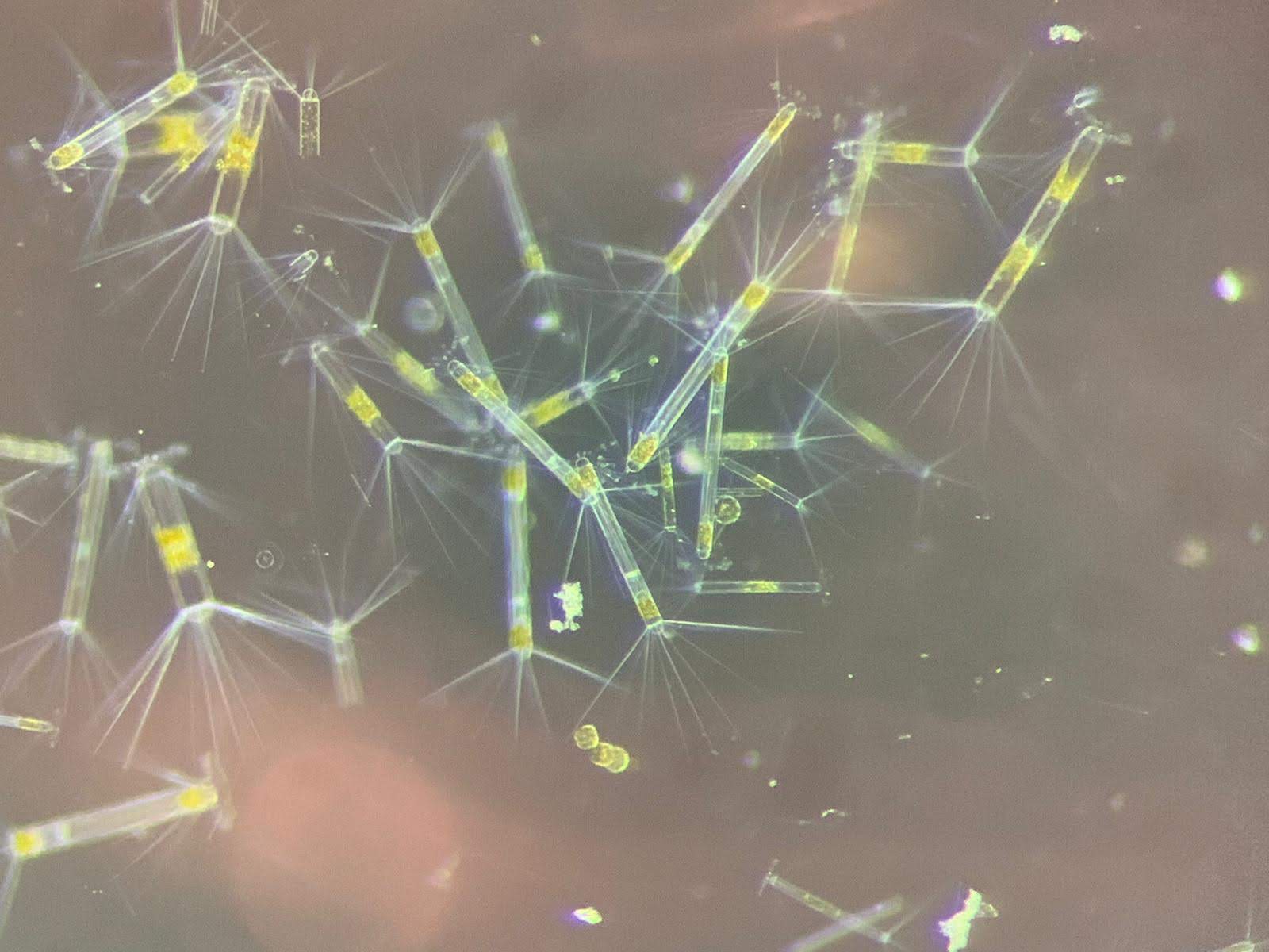 Corethron and chain-forming diatoms with delicate silica spines viewed under the microscope