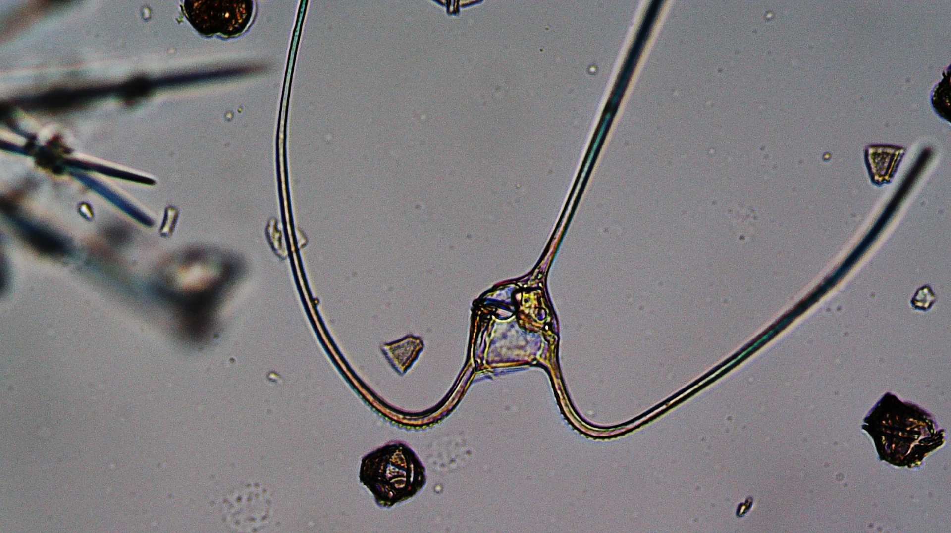 Microscopic dinoflagellate with long curved horns under brightfield microscopy