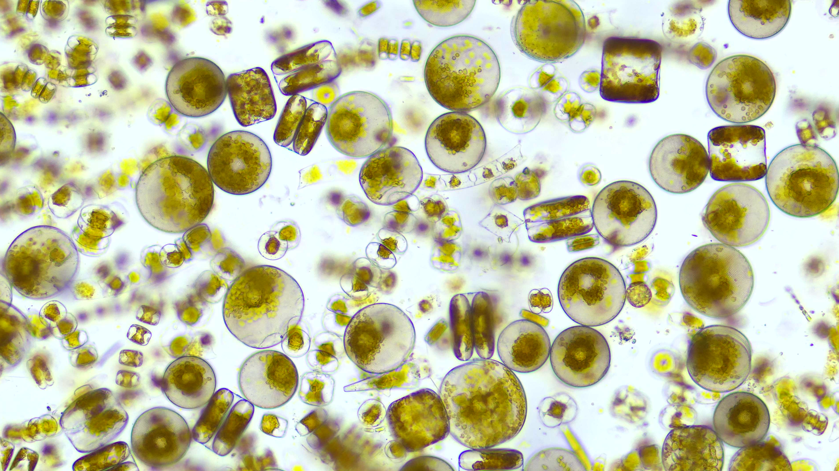 Microscopic view of diverse phytoplankton cells
